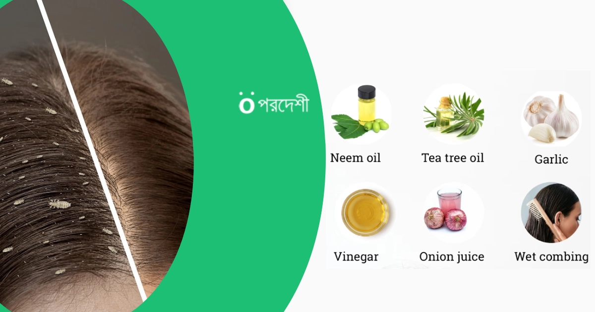 how to get rid of lice naturally one a day